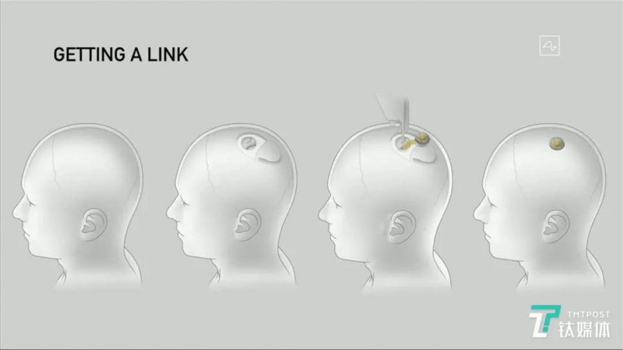 馬斯克腦機介面最新突破：猴子用意念玩遊戲